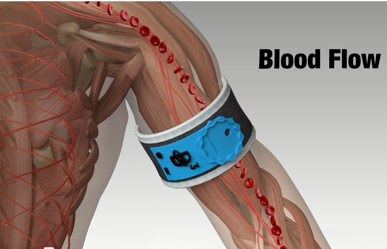 BFR Blood Flow Picture